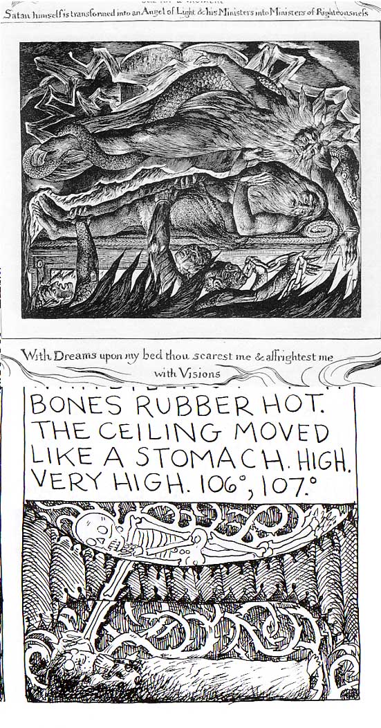 Blake-Barry-Stereoscope